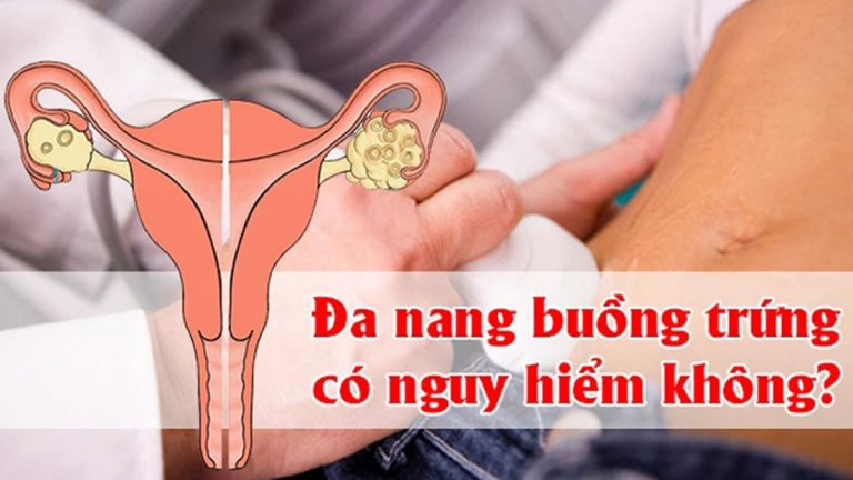 Đa Nang Buồng Trứng Có Nguy Hiểm Không?