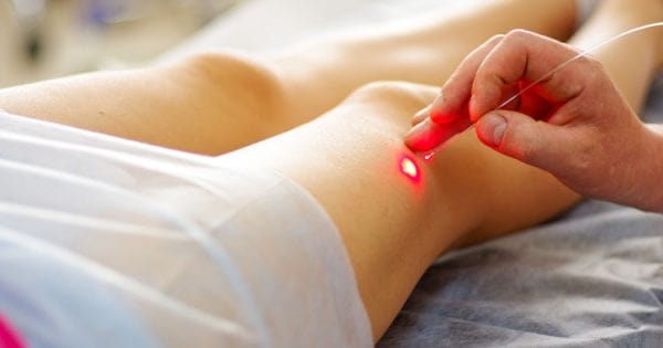 Tác Dụng Phụ Của Laser Nội Mạch