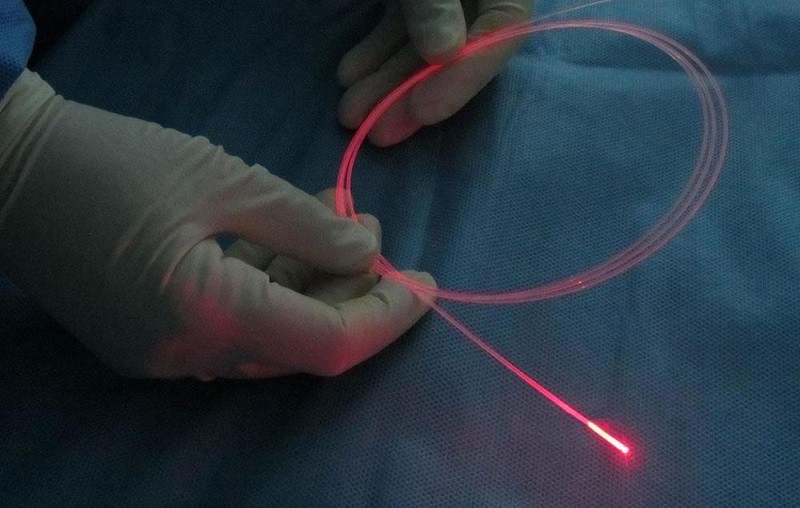 Tác Dụng Phụ Của Laser Nội Mạch