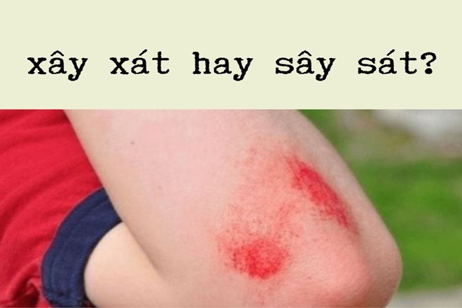 Sây sát hay xây xát